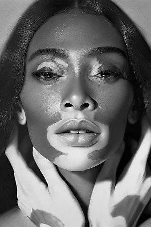 Winnie Harlow