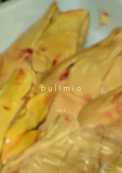 Bulimia