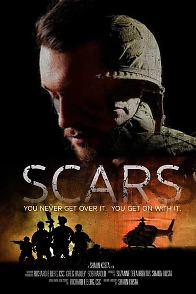 Scars