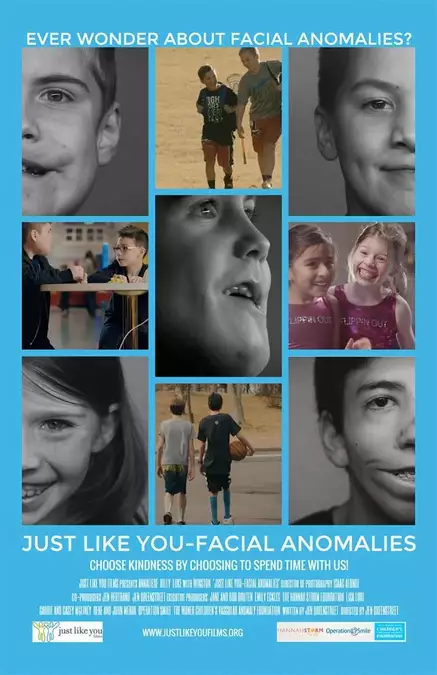 Just Like You: Facial Anomalies