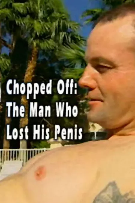 Chopped Off: The Man Who Lost His Penis