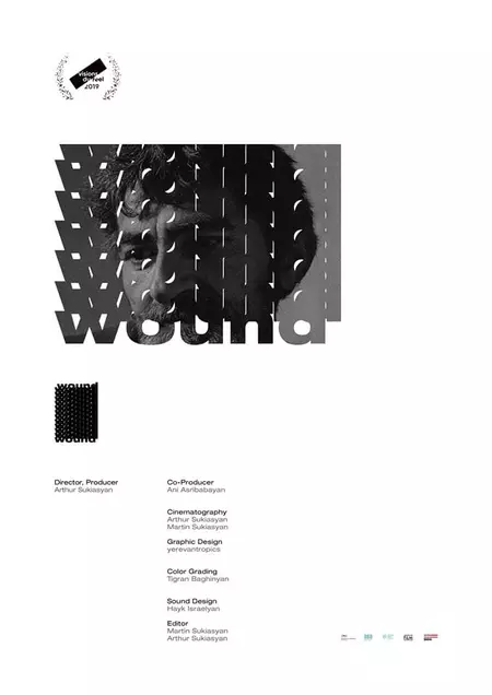 Wound