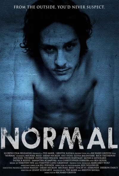 Normal