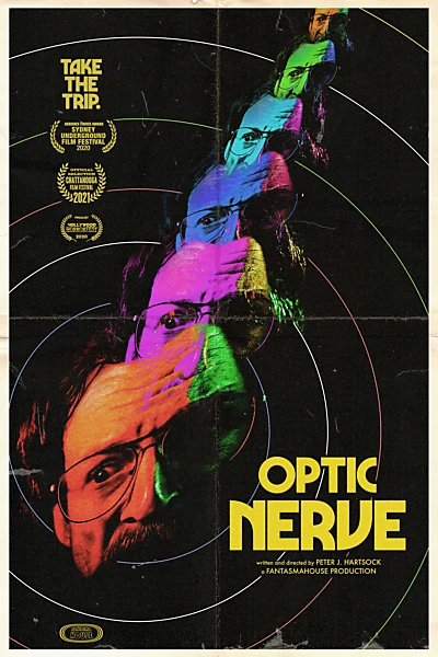 Optic Nerve