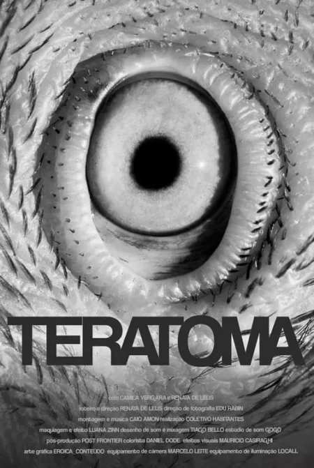 Teratoma