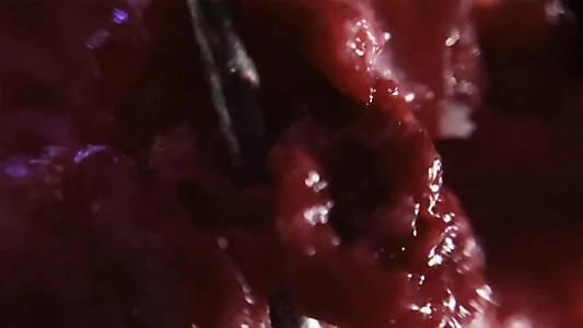 R52.9 Pain, unspecified