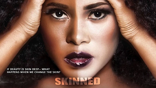 Watch Skinned Trailer