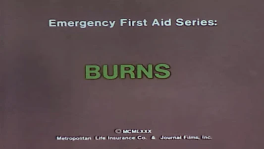 Emergency First Aid Series: Burns