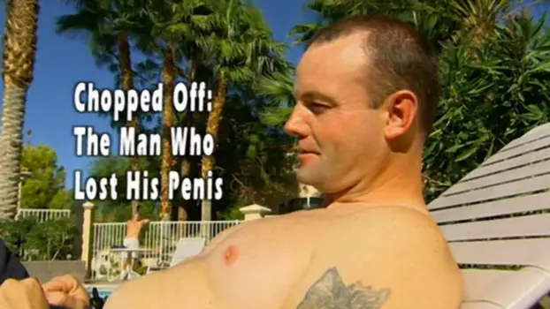 Chopped Off: The Man Who Lost His Penis