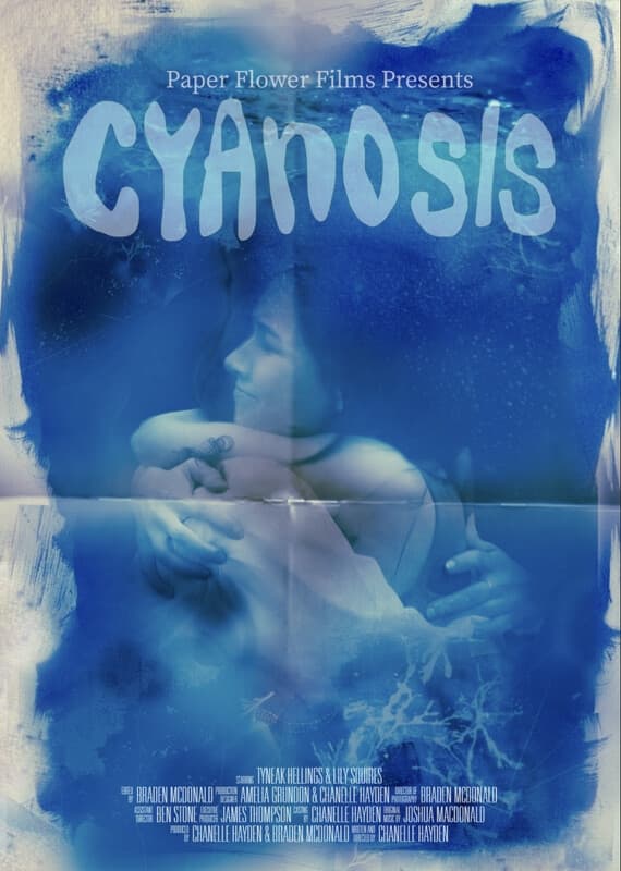 Cyanosis