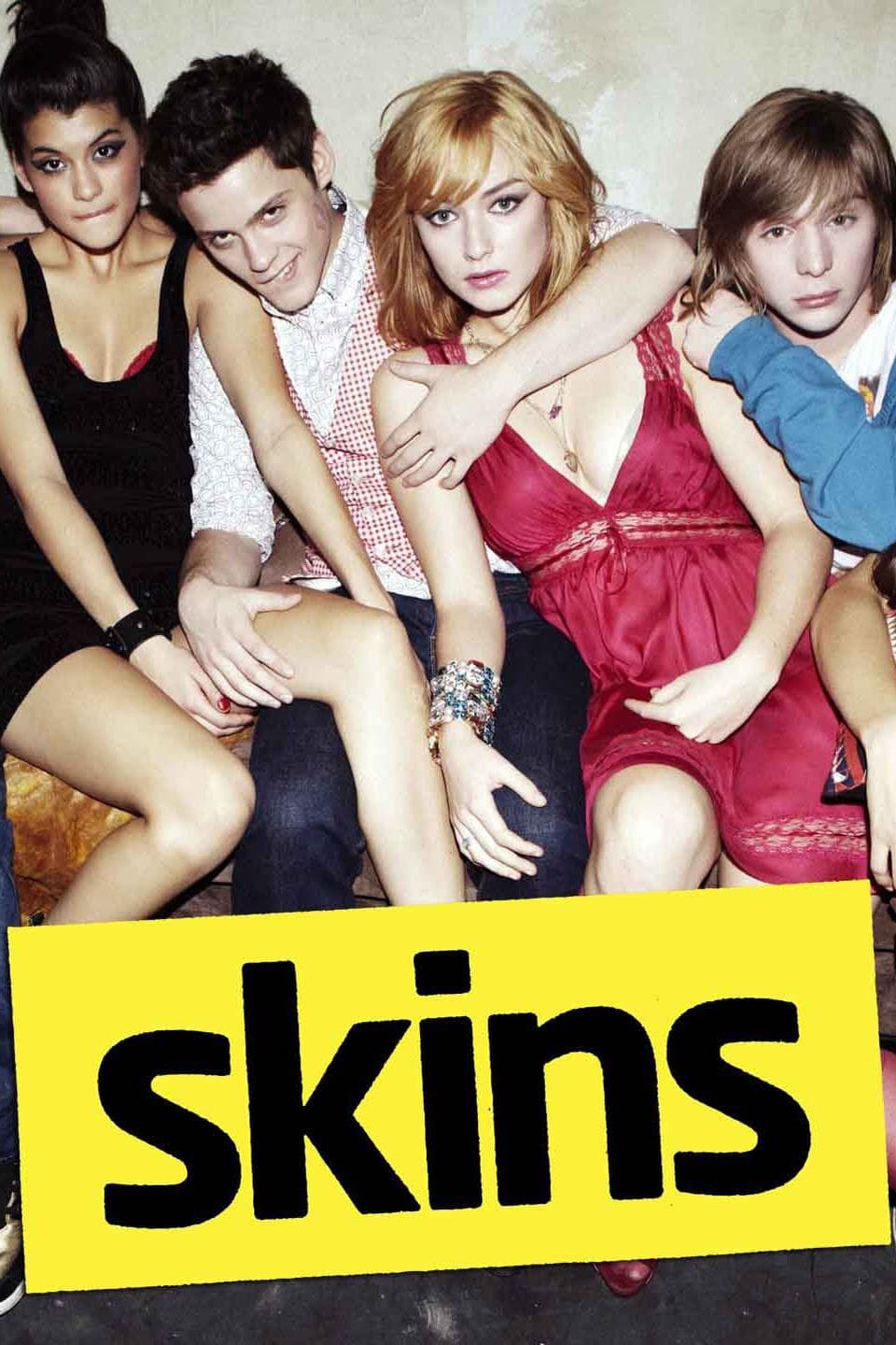 Skins UK