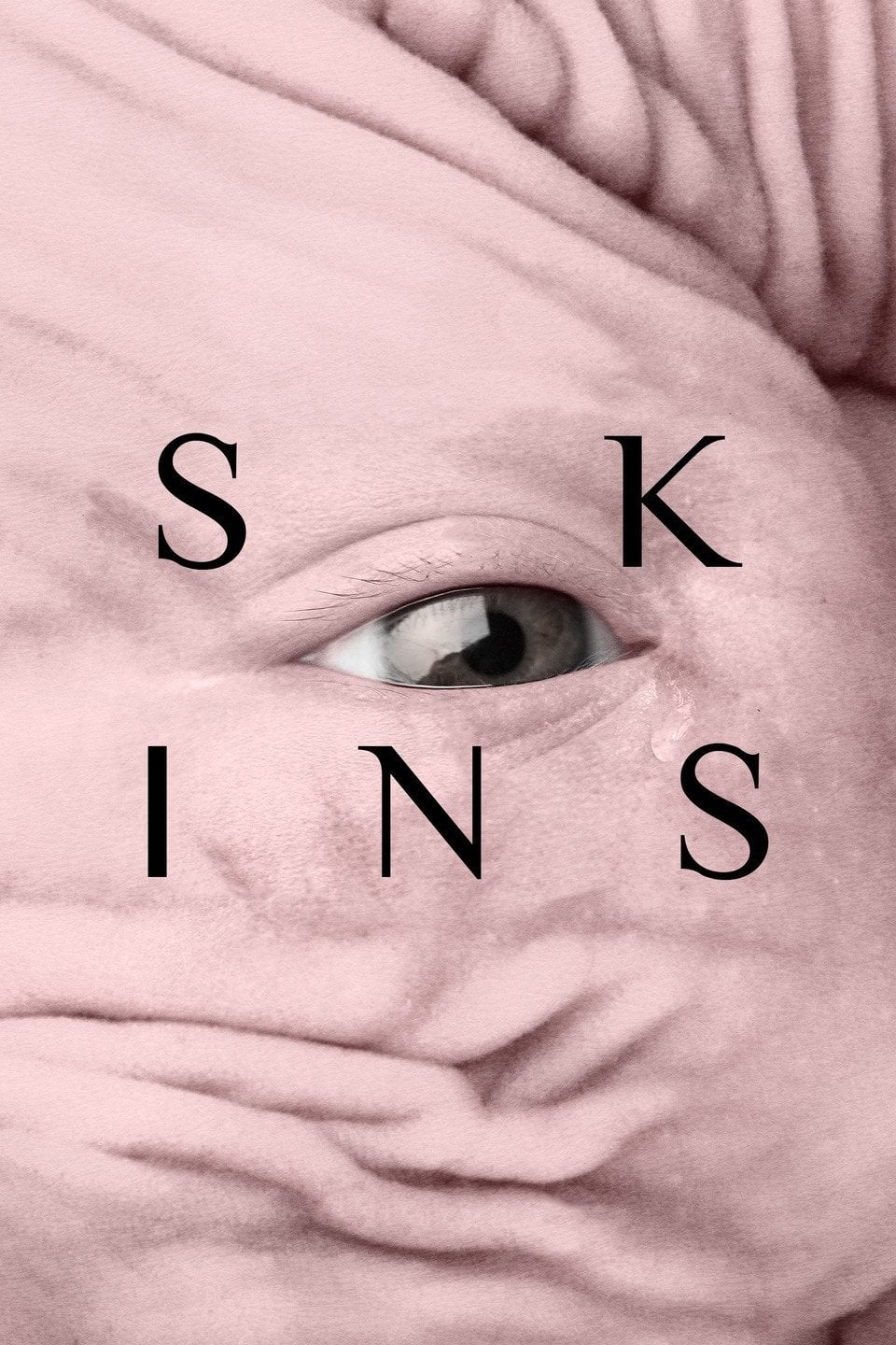 Skins (2017)