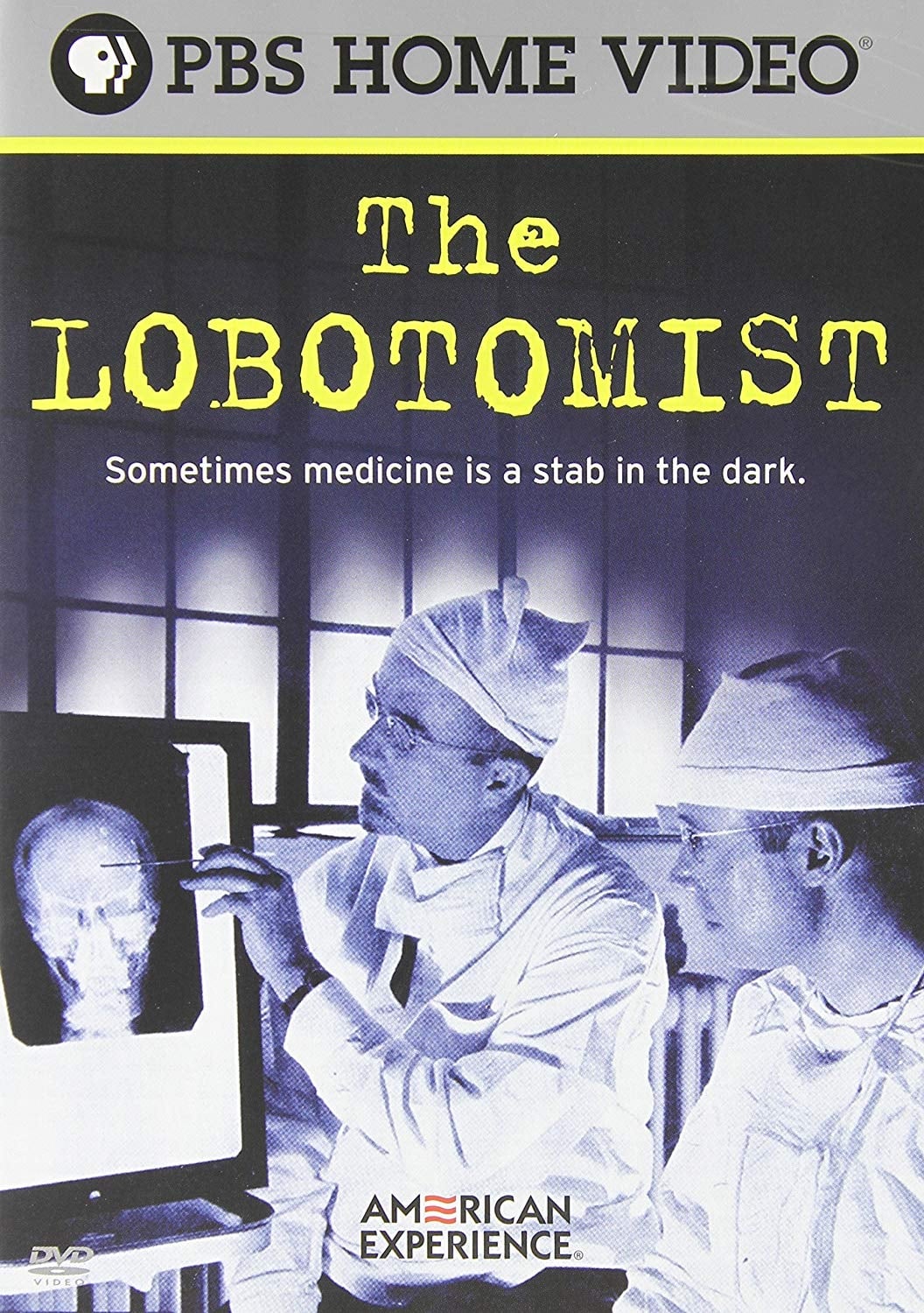 The Lobotomist