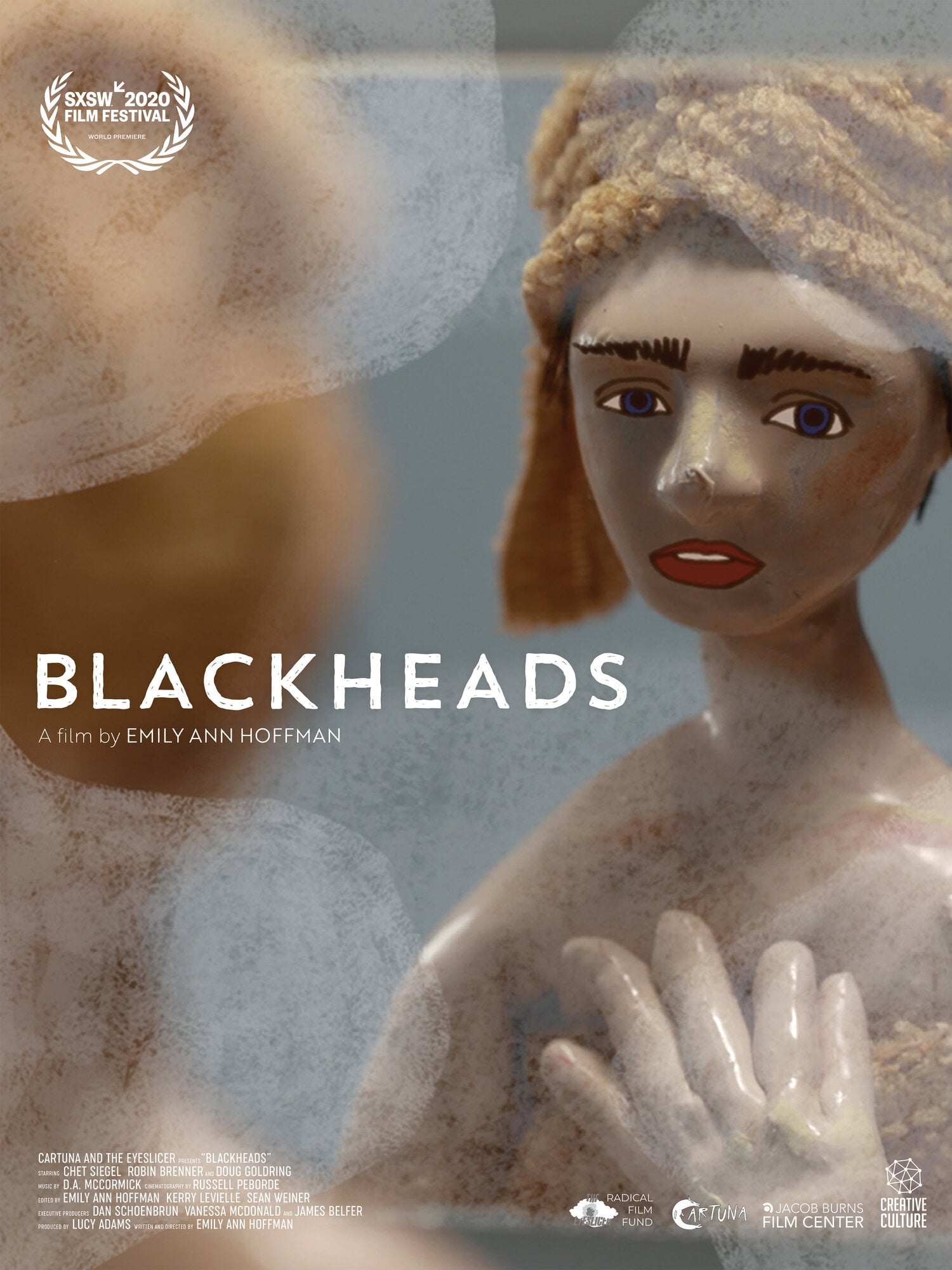 Blackheads