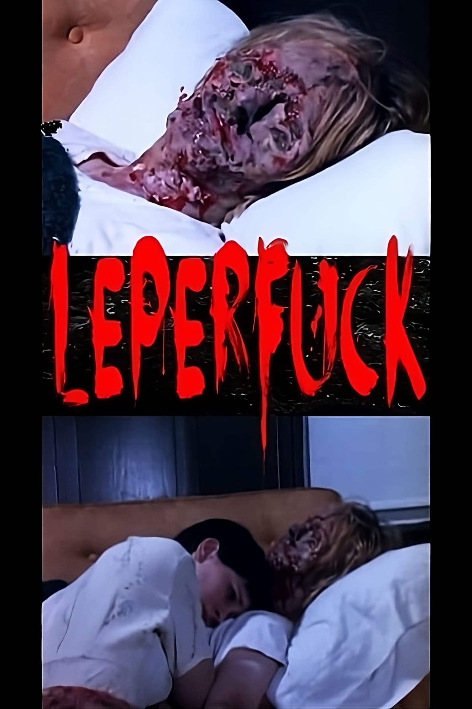 Leperfuck
