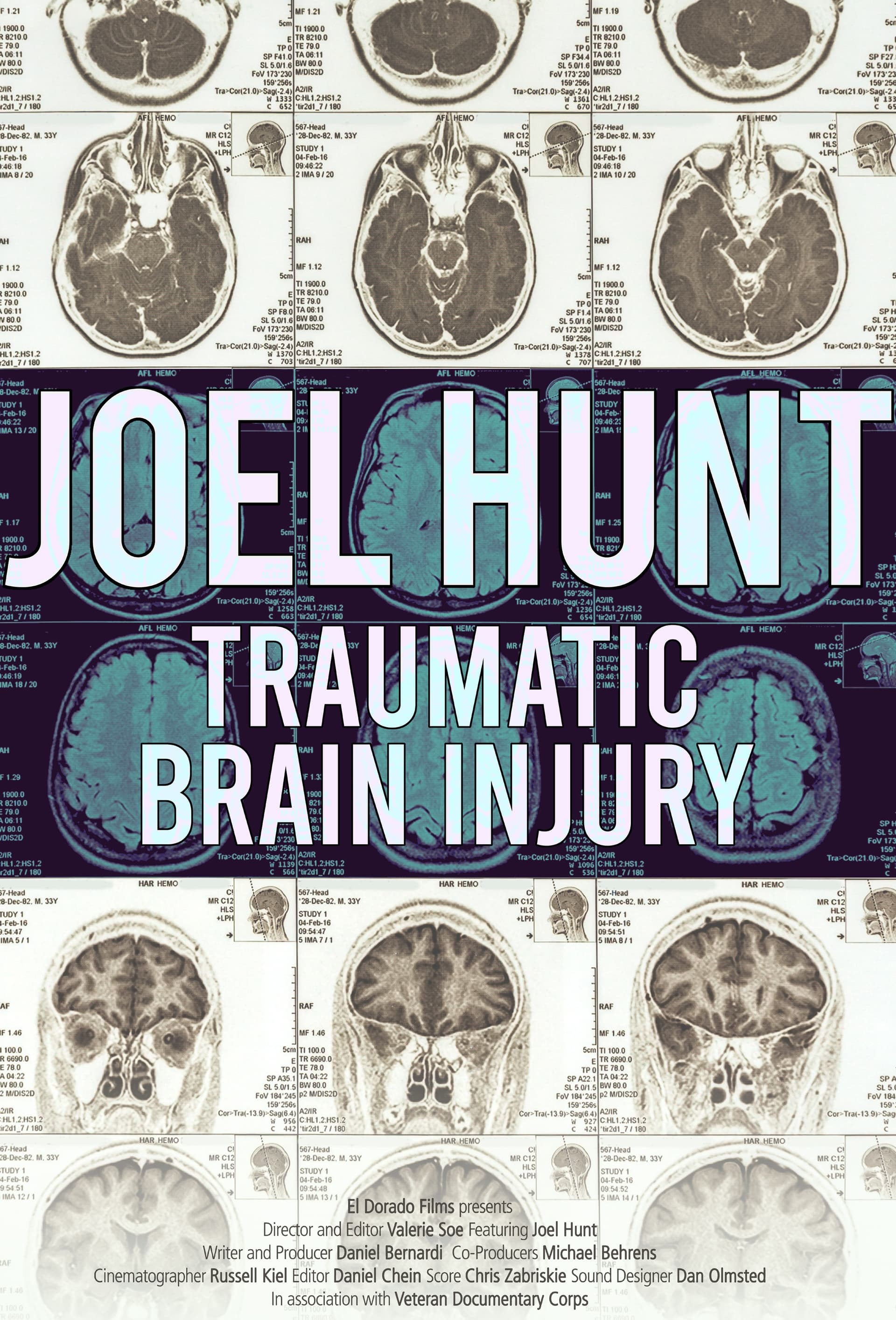 Joel Hunt: Traumatic Brain Injury (TBI) (2015)