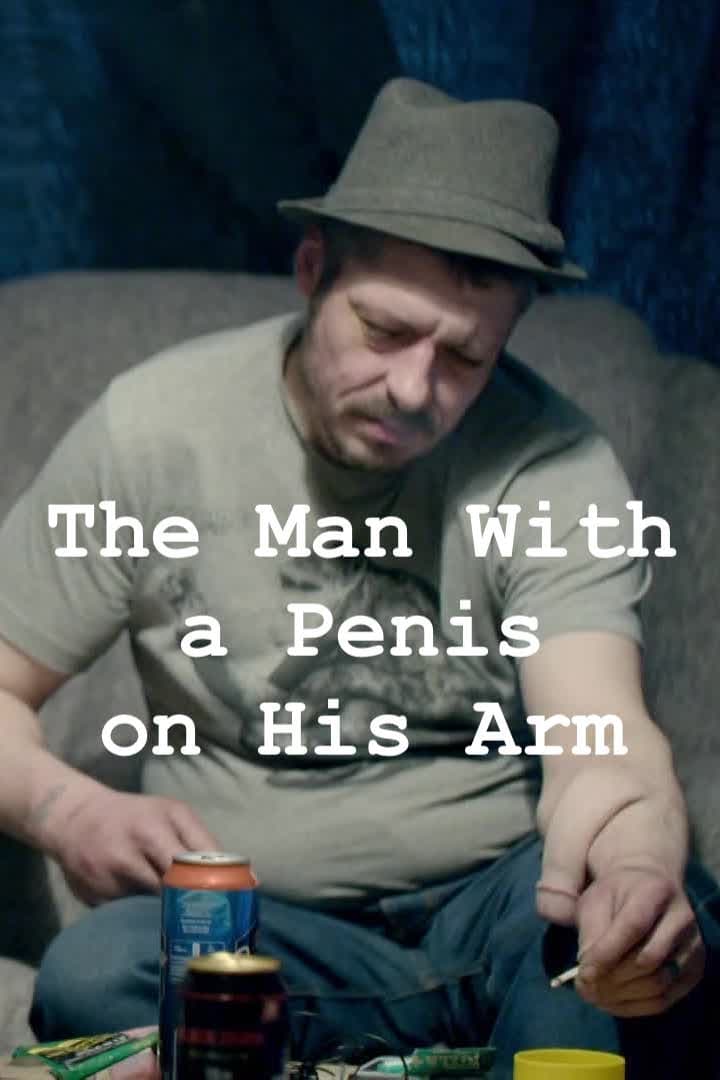 The Man With a Penis on His Arm