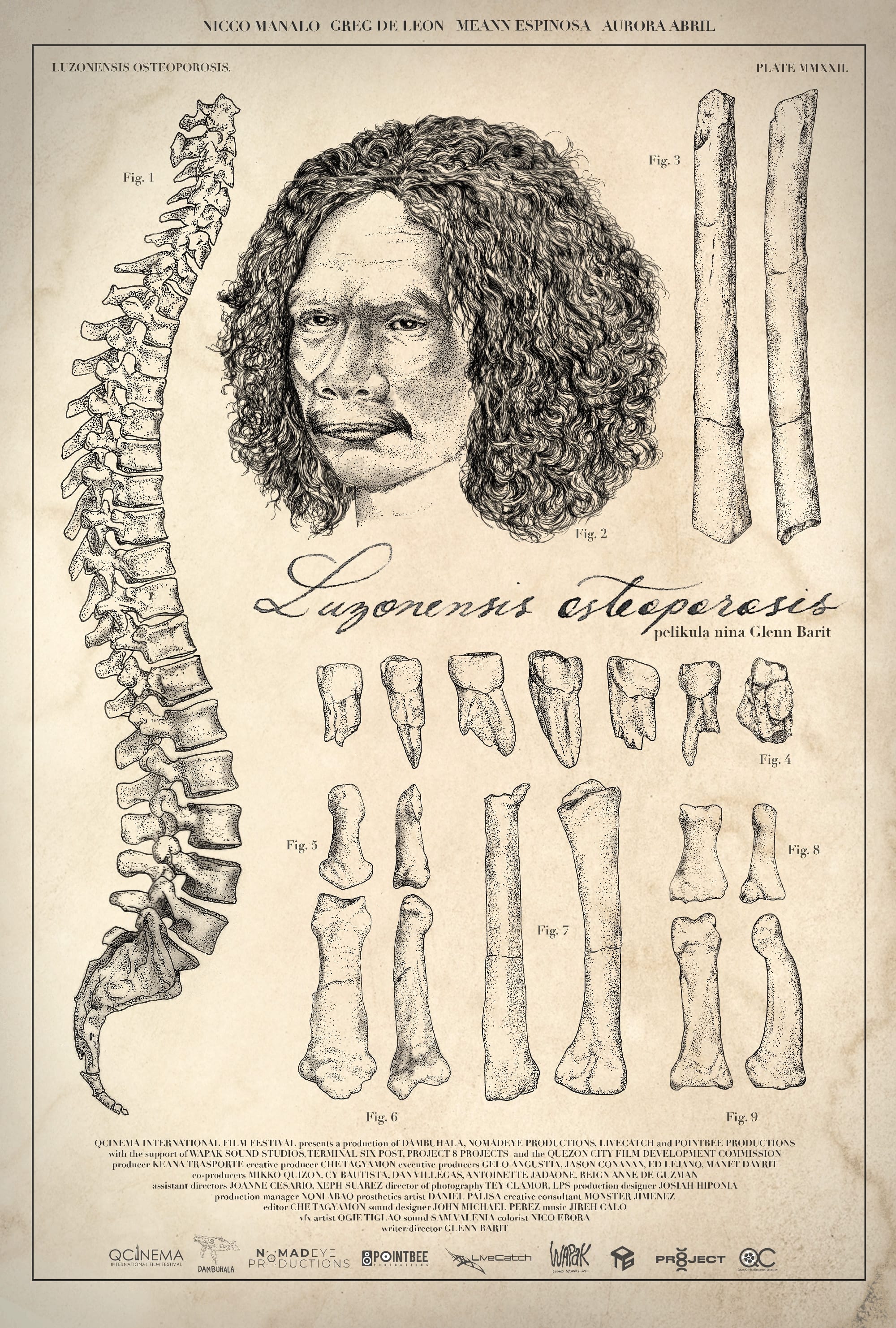 Luzonensis Osteoporosis