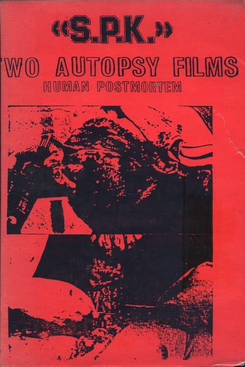 S.P.K.: Two Autopsy Films: Human Postmortem