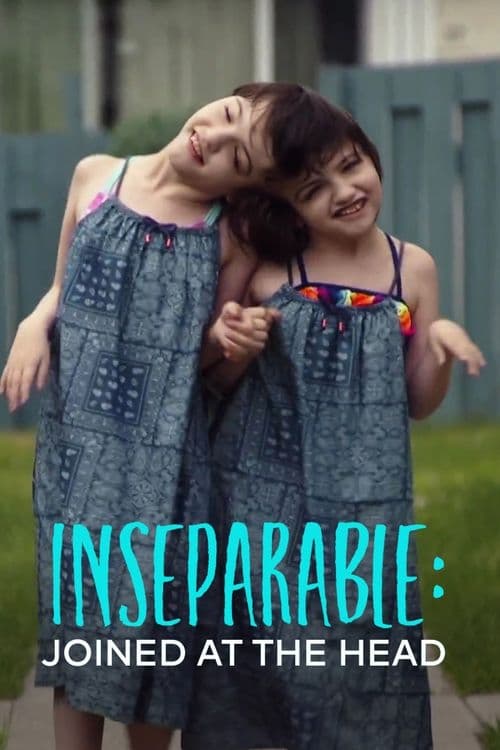 Inseparable: Ten Years Joined at the Head